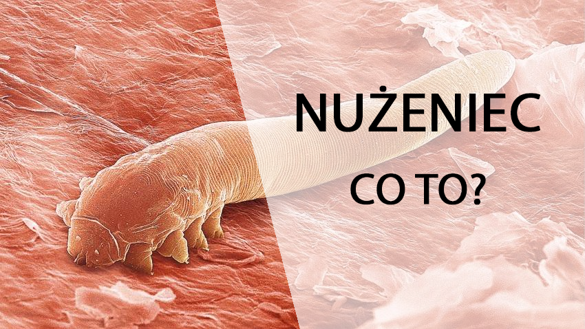 Nużeniec – czy możesz się nim zarazić