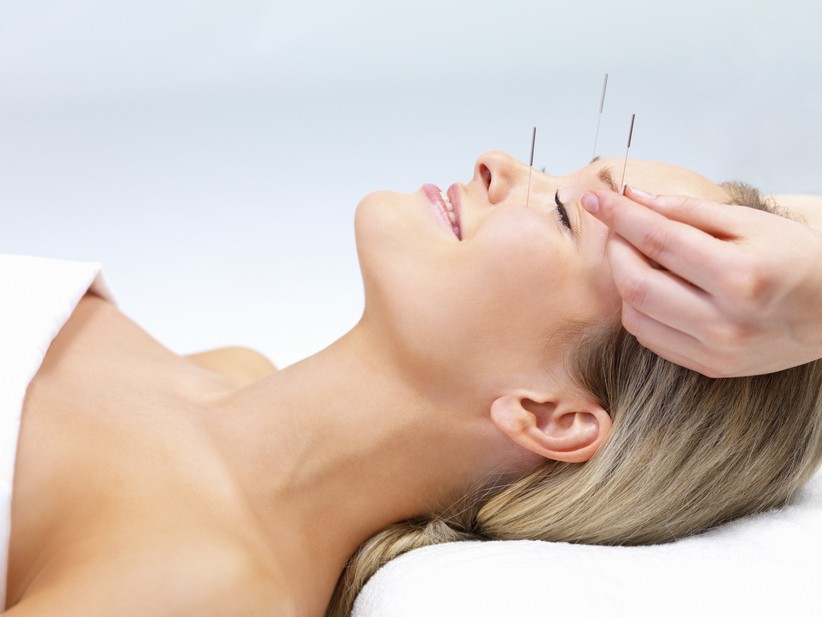 akupunktura-kosmetyczna