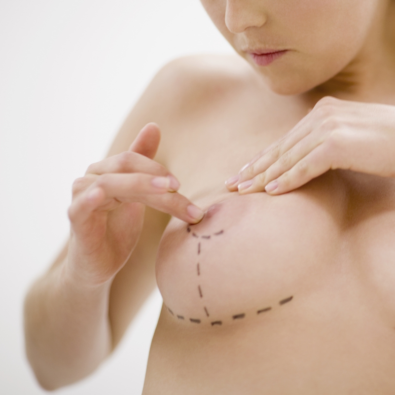 implanty-piersi-bezpieczenstwo-czy-ryzyko
